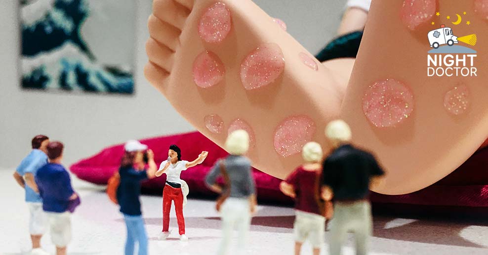 Parents' guide to hand, foot and mouth disease image